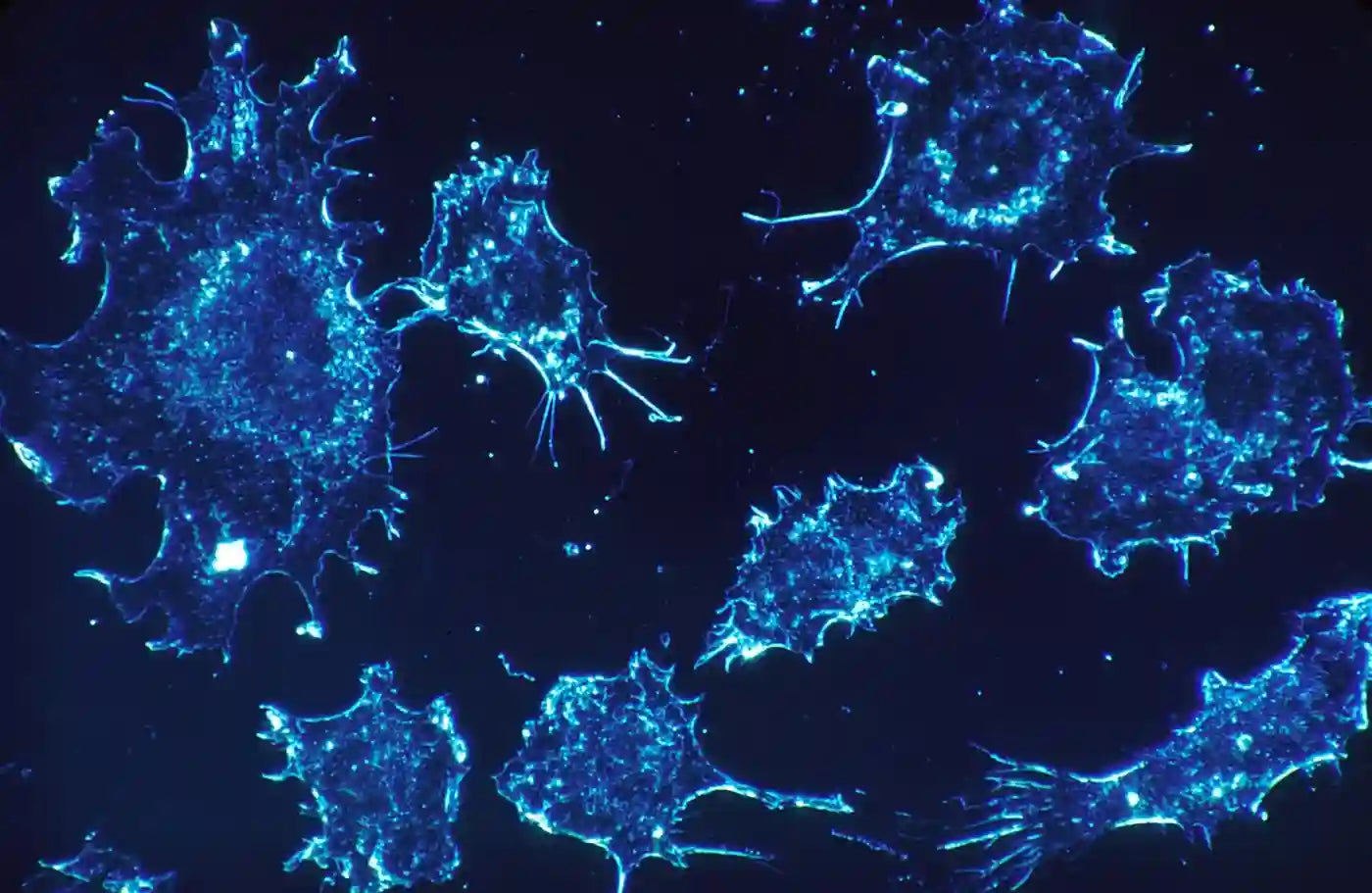 Pflanzliches Protein erhöht die Lebenserwartung